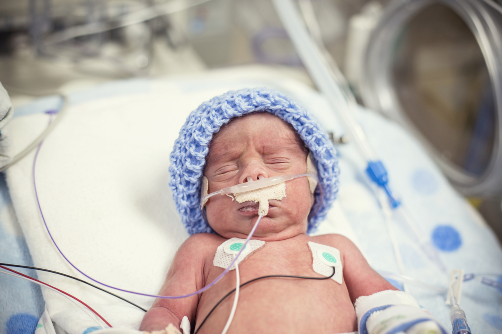 A premature baby in the Neonatal Intensive Care Unit (NICU).